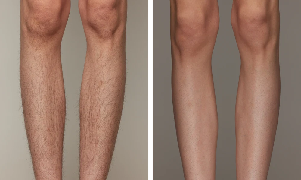 PIERNAS